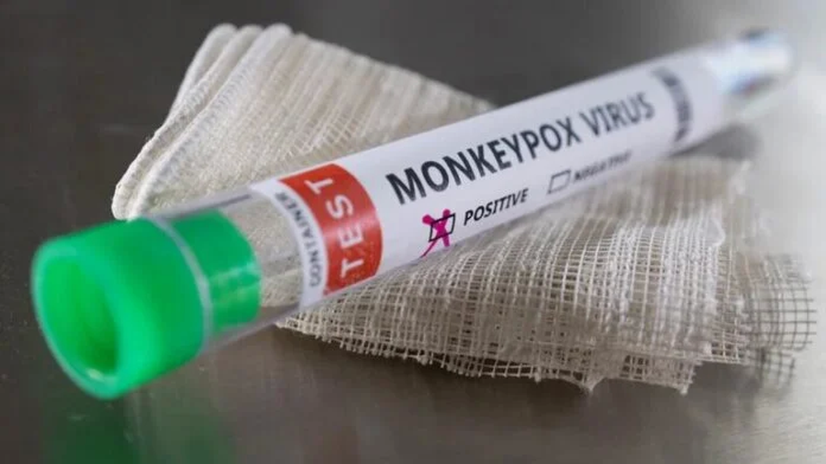 Estados Unidos planea distribuir vacunas de la viruela del mono a los contactos cercanos de personas infectadas. 