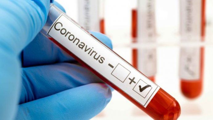Con 717 nuevos casos, el total de afectados en Argentina por coronavirus asciende a 15.419, con 520 muertos