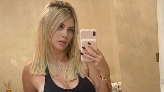 Wanda Nara enfrentó la polémica por sus fotos con filtro y aclaró si tiene cirugías