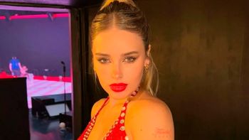 El inesperado pedido de Coti Romero tras realizarse un retoque en el rostro: Un poco inflamadita