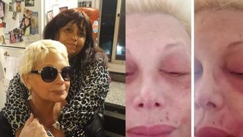 Marcela la “brujita de Quilmes” que le curó a Carmen Barbieri de la culebrilla: “Ahora le quedó una parálisis facial”