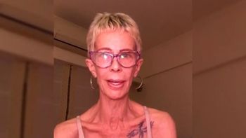 El dramático testimonio de María Valenzuela: Estoy pesando 35 kilos, no me puedo morir ahora