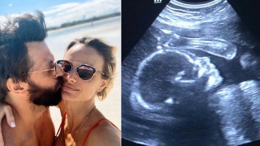 La primera imagen de Capri, la hija del Rifle Varela y Pía Marcollese