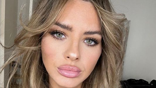 La impactante foto de la China Suárez ensangrentada tras sufrir un accidente