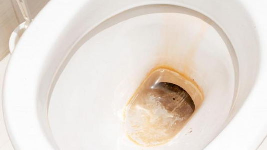 CHAU, sarro! Interior del inodoro BRILLANTE con ingredientes que tenés en casa