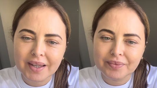 Qué es el metacrilato, la sustancia que le inyectaron a Silvina Luna y habría iniciado su enfermedad