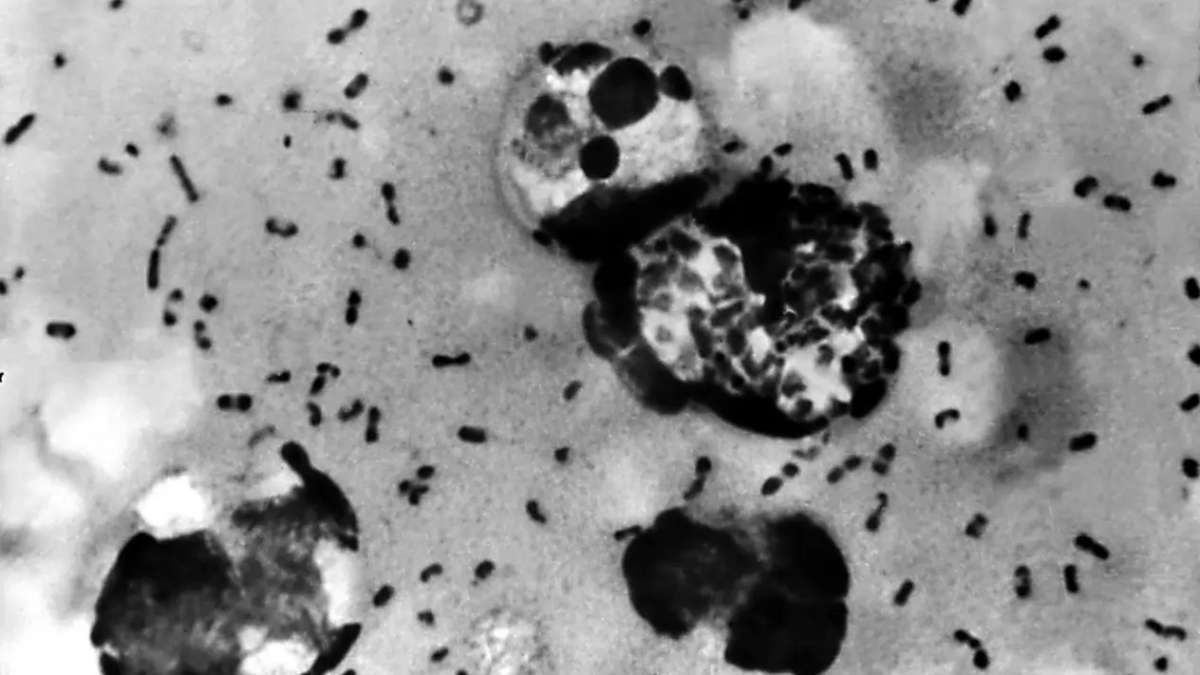 China confirma un caso de peste bubónica