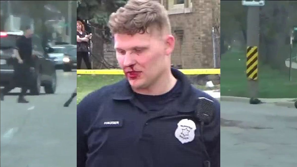 Así quedó el rostro de uno de los policías que intentó detener a Demetrius Lowe.