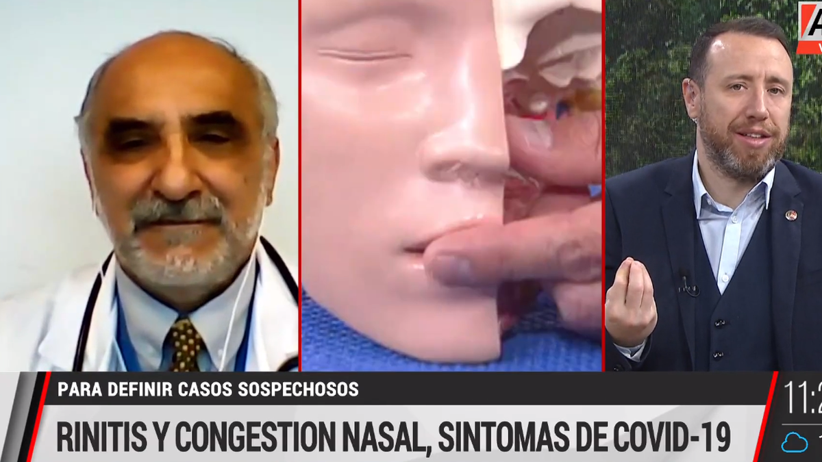 El médico Luis Camera explicó a A24 qué síntomas pueden representar un caso positivo de Covid-19.
