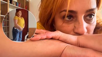 El impactante video de María Julia Oliván mostrando sus cicatrices tras el grave accidente