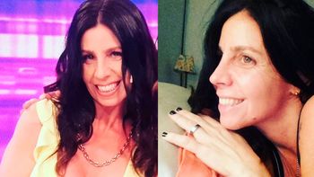 Así le quedó la nariz a Julieta Bal tras su operación: Estoy enamorada de vos