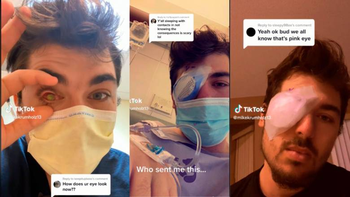 Joven se fue a dormir la siesta y cuando se despertó estaba ciego: el riesgo del higiene en los lentes de contacto