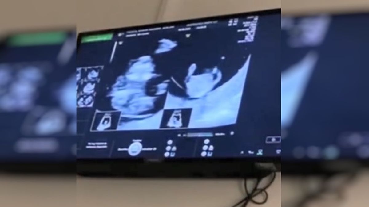 Nazarena V&eacute;lez, feliz y orgullosa de su hija, comparti&oacute; una de las ecograf&iacute;as de Barbie V&eacute;lez.