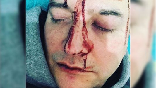 Leo García sufrió una tremenda golpiza de una patota homofóbica