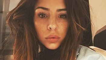 La dura confesión de Cande Tinelli sobre un problema del pasado