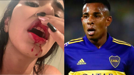 Sebastián Villa, figura de Boca, fue denunciado por violencia de género por su novia: las fotos de la golpiza