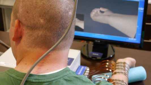 Un joven parapléjico logró mover su mano con la ayuda de un chip implantado en su cerebro