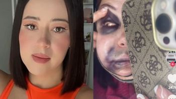 Se hizo una bichetomía y ahora vive un infierno: Miedo a quedar deforme