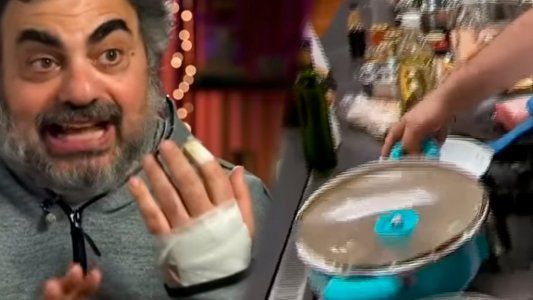El accidente de Roberto Moldasvky en Masterchef Celebrity: ¿Qué más me puede pasar?