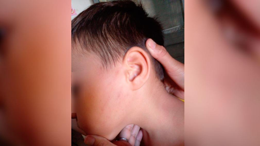 Palizas y maltratos: preocupación por la salud de un niño de 4 años golpeado por sus padres como Lucio Dupuy