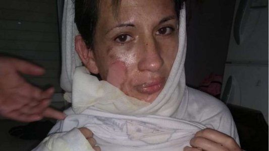Su pareja la prendió fuego con su beba recién nacida en brazos