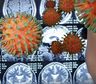 Hallazgo preocupante: detectan una atrofia cerebral en pacientes leves de Covid-19