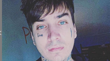 El papá de Eloy Rivera habló sobre la delicada salud de su hijo tras ser acuchillado: El verdadero problema de él son sus adicciones