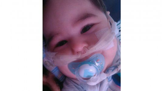 Tristeza enorme: Falleció Mateo, el bebé que movilizó a todo el país