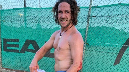 La impresionable foto de Carles Puyol ensangrentado tras un partido de paddle