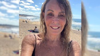 Pata Villanueva abrió un ojo y movió su pierna izquierda