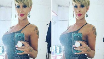 Mónica Farro tras su desmayo en el escenario: Según el médico, tuve un...