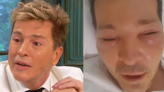 Guido Süller, internado por una fuerte hinchazón en la cara: No sé qué tengo