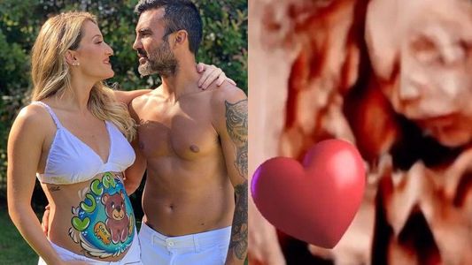 Mica Viciconte compartió una ecografía con la carita de su bebé