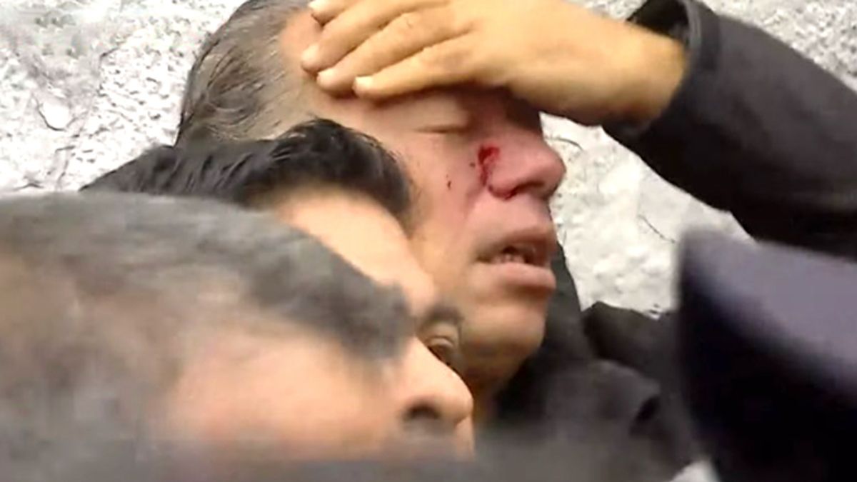 Sergio Berni. Así quedó el ministro de Seguridad bonaerense luego de la brutal agresión (Foto: archivo).