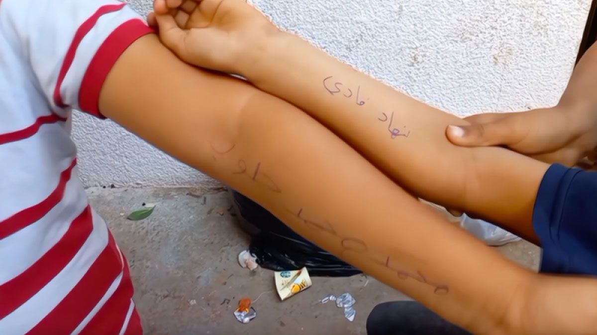 Grabar los nombres en los brazos de los niños gazatíes para ayudar a su identificación o a la de sus familias (Foto: Gentileza&nbsp;En.Sun.mv)