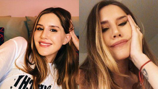 Micaela Tinelli confesó qué cirugía se hizo en la cara hace pocos días