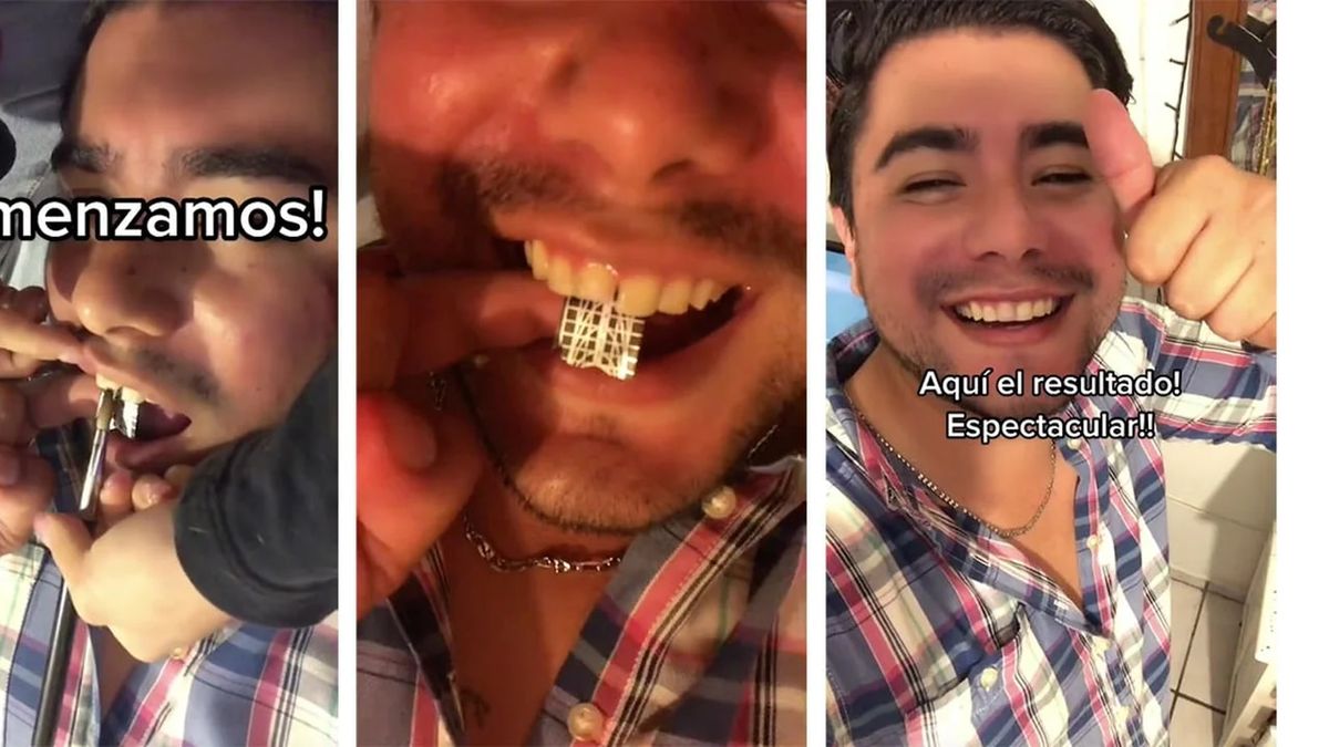 Video: su novia le arregló un diente con un increíble método