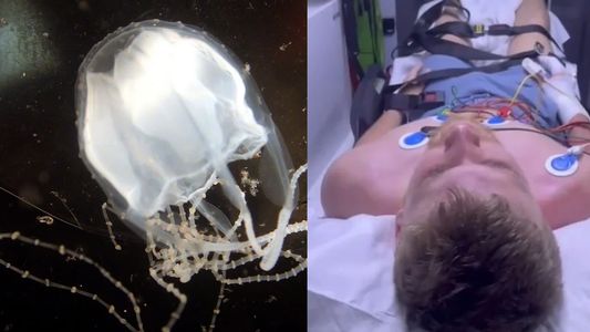 La medusa letal: El veneno llegó hasta el corazón
