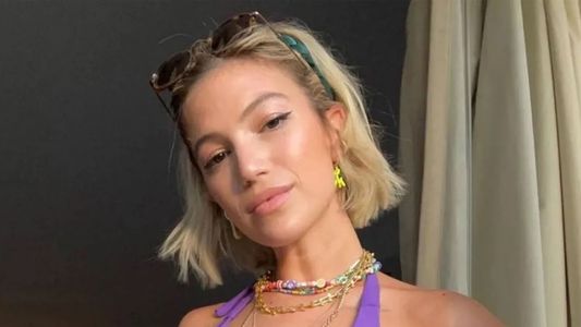 La impactante foto de Stefi Roitman con unas extrañas marcas sobre su cuerpo