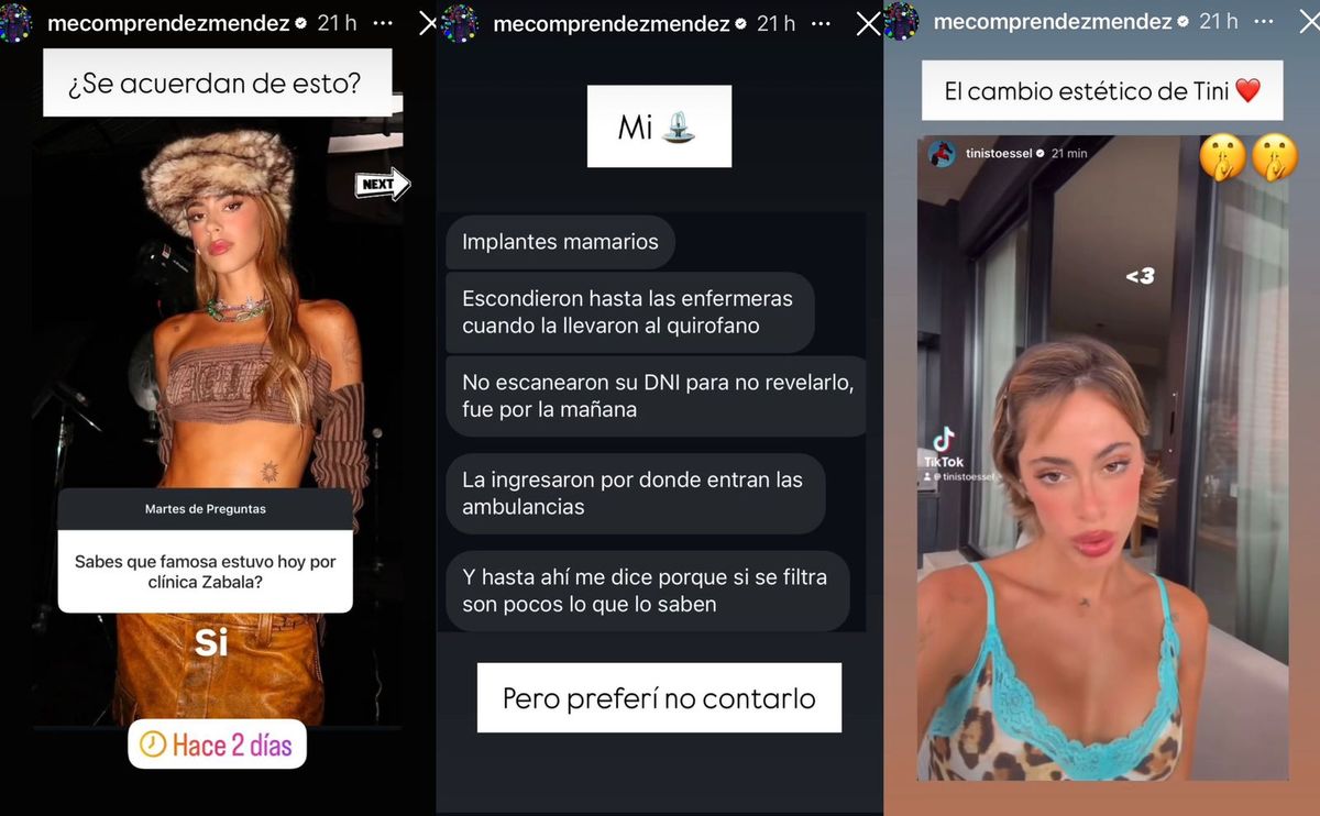 Se filtró la secreta y sorpresiva cirugía estética a la que se animó Tini  Stoessel: aquí el antes y el ahora