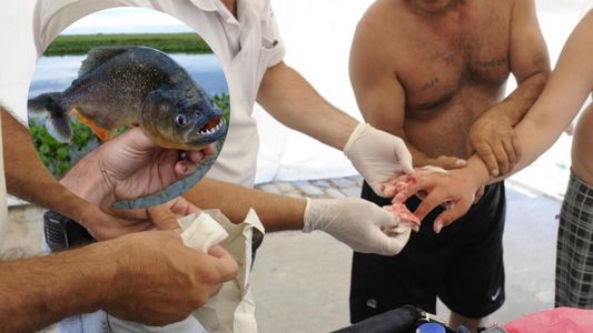 Palometas: ¿qué hacer frente a una mordedura y como prevenir el ataque?