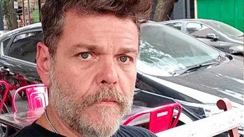 La DAIA condenó los dichos de Alfredo Casero y lo acusó de banalizar el Holocausto