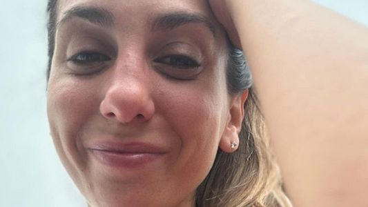 Cinthia Fernández sufrió un doloroso accidente en sus vacaciones: el video