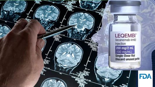 Leqembi: cuán efectiva es la nueva droga contra el Alzheimer y cuánto cuesta