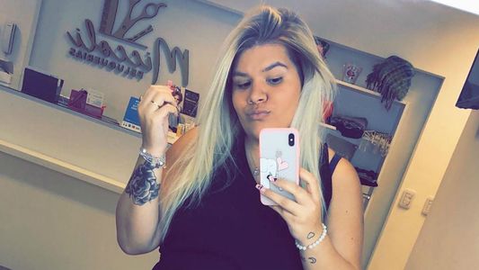 Morena Rial se hizo un retoque en sus labios a tres meses de dar a luz a su hijo