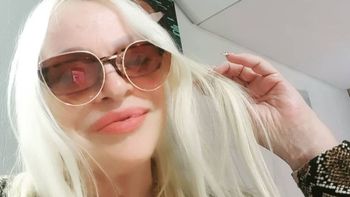 Silvia Süller habló tras su preocupante accidente y dio detalles de cómo se encuentra: Soy muy fuerte