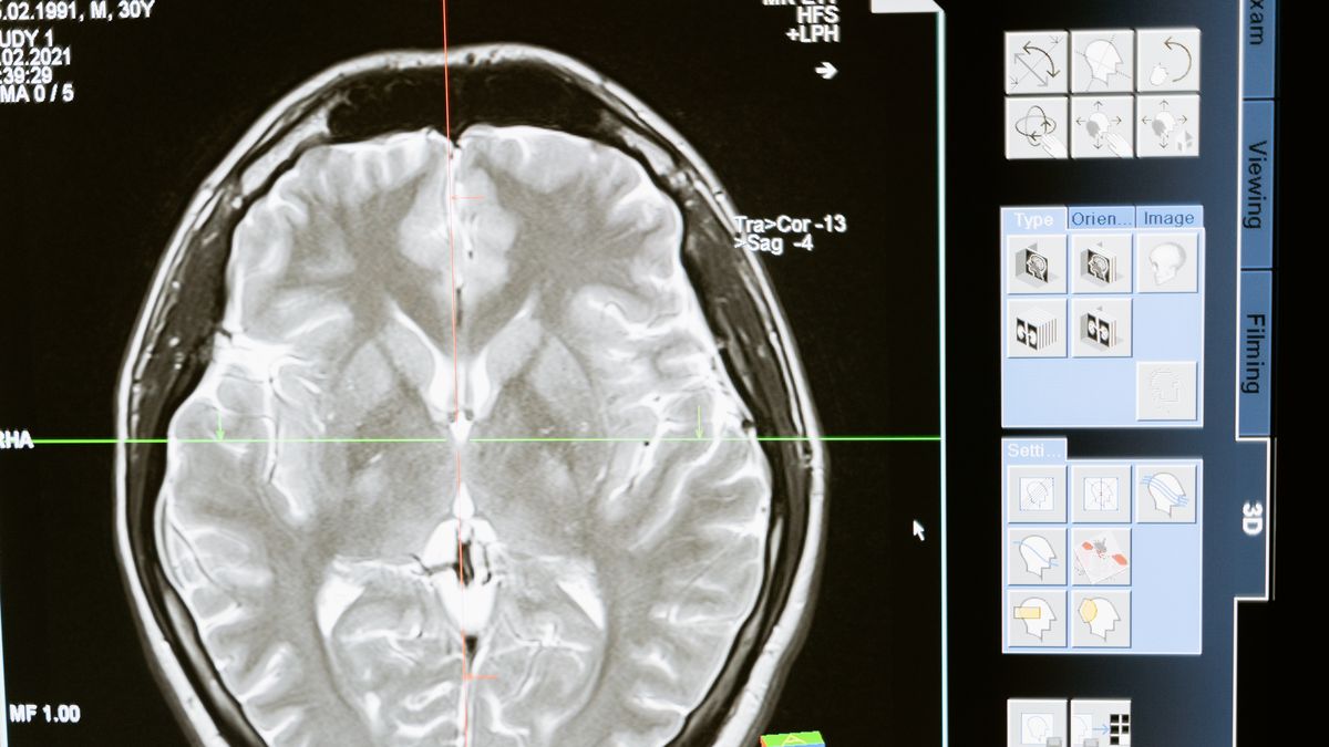 22 de julio - Día mundial del cerebro&nbsp;