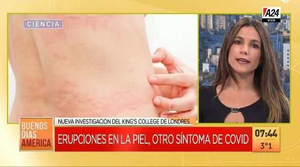 Las erupciones en la piel podrían ser un nuevo síntoma del COVID-19