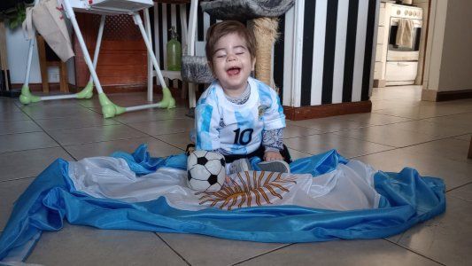 Benjamín, el único nene con síndrome de Gould en la Argentina