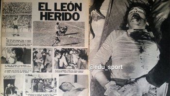 Caso Andrada: el día que Hugo Gatti sufrió una triple fractura de mandíbula y volvió al mes